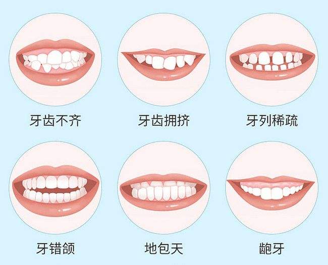 兰州牙齿矫正
