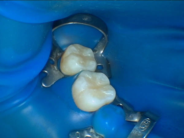 兰州牙科,兰州口腔,兰州种植牙,兰州根管治疗,兰州补牙,兰州牙齿矫正