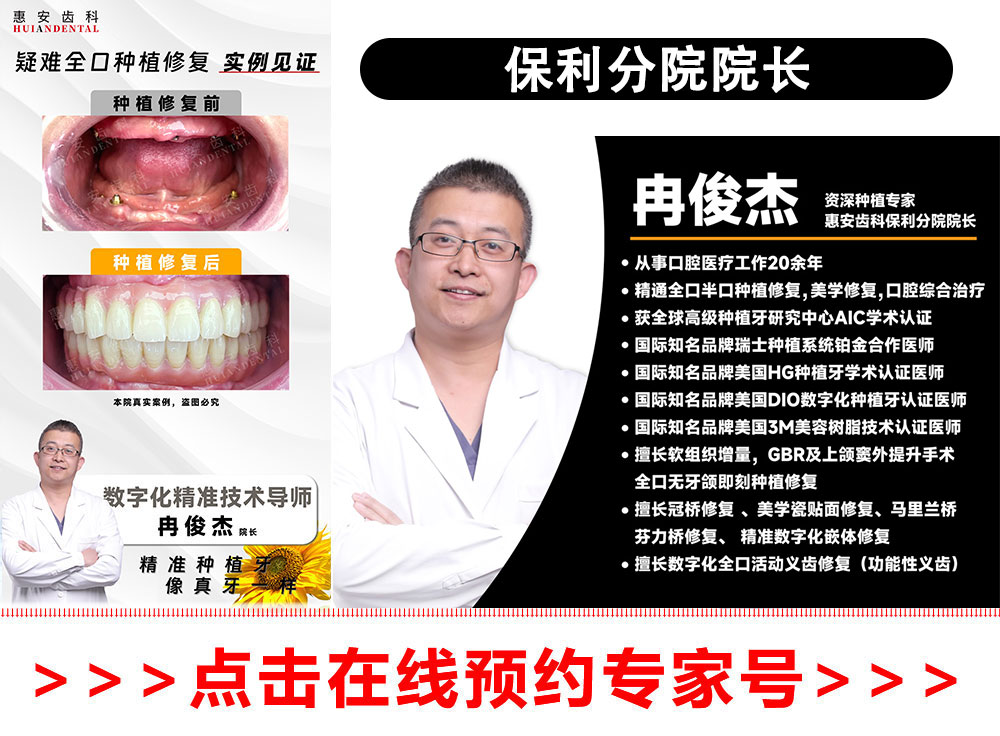 兰州牙科，兰州口腔，兰州种植牙，兰州种植牙，兰州种植牙医院，兰州种植牙口腔