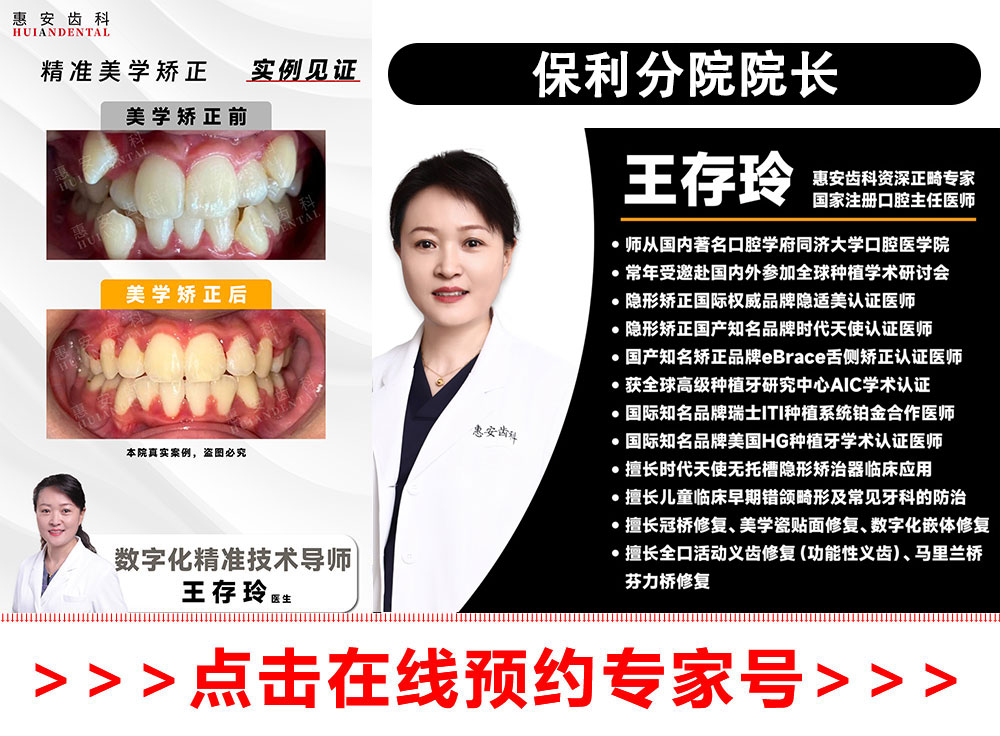 兰州牙齿矫正,兰州牙齿矫正推荐,兰州牙齿矫正医生,兰州正畸,兰州正畸推荐,兰州正畸医生